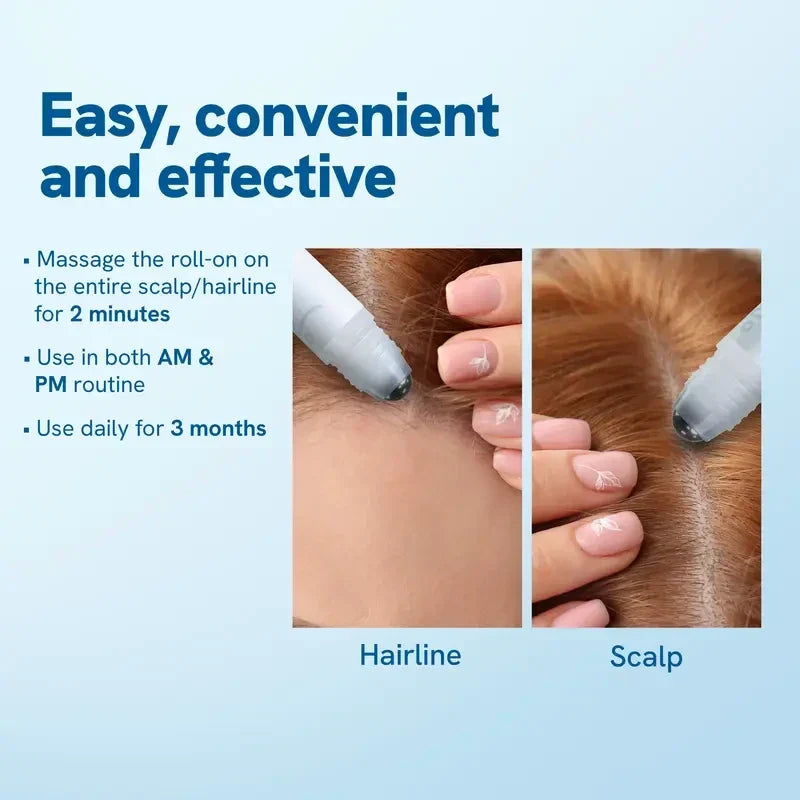 Rosemary Scalp Roll-On Serum – Hair Growth Activator with Redensyl & Anagain (25 ml)