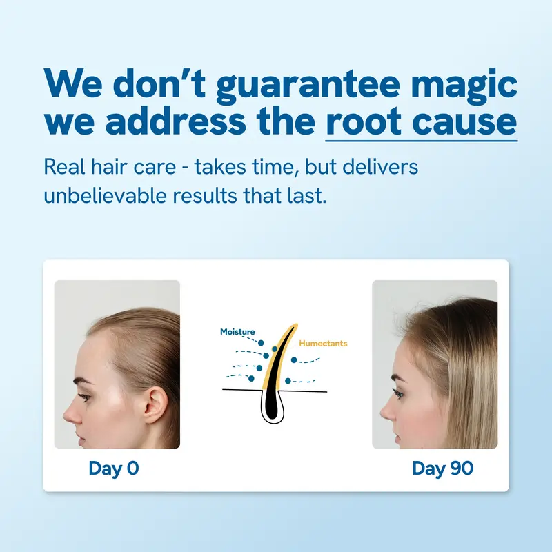 Rosemary Scalp Roll-On Serum – Hair Growth Activator with Redensyl & Anagain (25 ml)